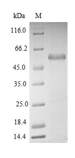 SEPHS1 / SPS Protein - (Tris-Glycine gel) Discontinuous SDS-PAGE (reduced) with 5% enrichment gel and 15% separation gel.