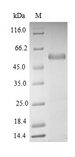 SEPHS1 / SPS Protein - (Tris-Glycine gel) Discontinuous SDS-PAGE (reduced) with 5% enrichment gel and 15% separation gel.