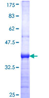 SEPHS1 / SPS Protein - 12.5% SDS-PAGE Stained with Coomassie Blue.