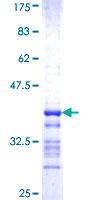 SEPHS2 Protein - 12.5% SDS-PAGE Stained with Coomassie Blue.
