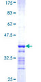 SEPHS2 Protein - 12.5% SDS-PAGE Stained with Coomassie Blue.