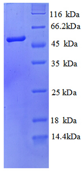 SEPSECS Protein