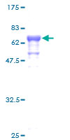 SEPT1 / Septin 1 Protein - 12.5% SDS-PAGE of human SEPT1 stained with Coomassie Blue