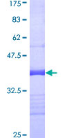 SEPT11 / Septin 11 Protein - 12.5% SDS-PAGE Stained with Coomassie Blue.