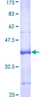 SEPT12 / Septin 12 Protein - 12.5% SDS-PAGE Stained with Coomassie Blue.