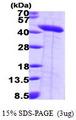 SEPT2 / Septin 2 Protein