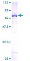 SEPT5 / Septin 5 Protein - 12.5% SDS-PAGE of human SEPT5 stained with Coomassie Blue