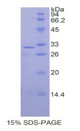 SEPT5 / Septin 5 Protein - Recombinant Septin 5 By SDS-PAGE