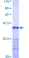 SEPT7 / Septin 7 Protein - 12.5% SDS-PAGE Stained with Coomassie Blue.