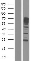 SEPT9 / Septin 9 Protein - Western validation with an anti-DDK antibody * L: Control HEK293 lysate R: Over-expression lysate