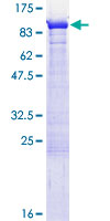 SEPT9 / Septin 9 Protein - 12.5% SDS-PAGE of human SEPT9 stained with Coomassie Blue