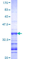 SEPT9 / Septin 9 Protein - 12.5% SDS-PAGE Stained with Coomassie Blue.