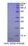 SEPW1 / Selenoprotein W Protein - Recombinant Selenoprotein W1 By SDS-PAGE