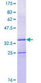 SEPX1 / Selenoprotein R Protein - 12.5% SDS-PAGE of human SEPX1 stained with Coomassie Blue