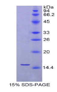 SEPX1 / Selenoprotein R Protein - Recombinant Selenoprotein X1 By SDS-PAGE