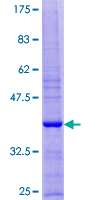 SERF1A / SERF1 Protein - 12.5% SDS-PAGE of human SERF1A stained with Coomassie Blue