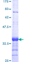 SERF1A / SERF1 Protein - 12.5% SDS-PAGE Stained with Coomassie Blue.