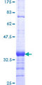 SERF1A / SERF1 Protein - 12.5% SDS-PAGE Stained with Coomassie Blue.