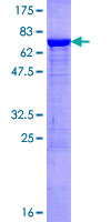 SERPINA1 / Alpha 1 Antitrypsin Protein - 12.5% SDS-PAGE of human SERPINA1 stained with Coomassie Blue