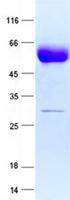 SERPINA1 / Alpha 1 Antitrypsin Protein