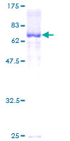 SERPINA10 / PZI Protein - 12.5% SDS-PAGE of human SERPINA10 stained with Coomassie Blue
