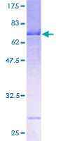 SERPINA12 / Vaspin Protein - 12.5% SDS-PAGE of human SERPINA12 stained with Coomassie Blue