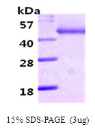 SERPINA12 / Vaspin Protein
