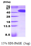 SERPINA5 / PCI Protein