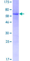 SERPINA6 / CBG Protein - 12.5% SDS-PAGE of human SERPINA6 stained with Coomassie Blue