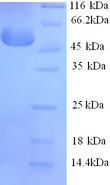 SERPINA6 / CBG Protein