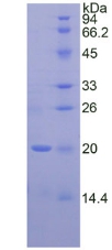 SERPINA6 / CBG Protein - Recombinant Corticosteroid Binding Globulin By SDS-PAGE