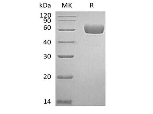 SERPINA7 / TBG Protein - Recombinant Human Serpin A7/TBG (C-6His)