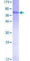 SERPINA7 / TBG Protein - 12.5% SDS-PAGE of human SERPINA7 stained with Coomassie Blue
