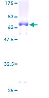 SERPINB1 Protein - 12.5% SDS-PAGE of human SERPINB1 stained with Coomassie Blue