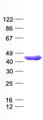 SERPINB1 Protein