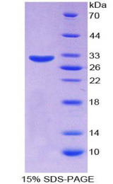SERPINB1 Protein - Recombinant Leukocyte Elastase Inhibitor By SDS-PAGE