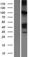 SERPINB11 / EPIPIN Protein - Western validation with an anti-DDK antibody * L: Control HEK293 lysate R: Over-expression lysate