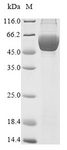 SERPINB2 / PAI-2 Protein - (Tris-Glycine gel) Discontinuous SDS-PAGE (reduced) with 5% enrichment gel and 15% separation gel.