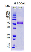 SERPINB3 Protein - SDS-PAGE under reducing conditions and visualized by Coomassie blue staining
