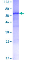 SERPINB3 Protein - 12.5% SDS-PAGE of human SERPINB3 stained with Coomassie Blue