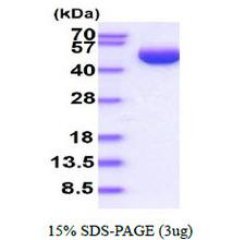 SERPINB3 Protein