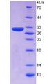 SERPINB3 Protein - Recombinant Squamous Cell Carcinoma Antigen 1 By SDS-PAGE