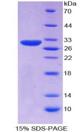 SERPINB3 Protein - Recombinant Squamous Cell Carcinoma Antigen 1 By SDS-PAGE