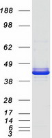 SERPINB3 Protein - Purified recombinant protein SERPINB3 was analyzed by SDS-PAGE gel and Coomassie Blue Staining