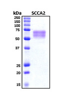 SERPINB4 / SCCA1+2 Protein - SDS-PAGE under reducing conditions and visualized by Coomassie blue staining