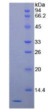 SERPINB4 / SCCA1+2 Protein - Recombinant Squamous Cell Carcinoma Antigen 2 By SDS-PAGE