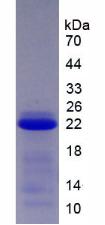 SERPINB4 / SCCA1+2 Protein - Recombinant Squamous Cell Carcinoma Antigen 2 (SCCA2) by SDS-PAGE