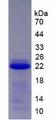 SERPINB4 / SCCA1+2 Protein - Recombinant Squamous Cell Carcinoma Antigen 2 (SCCA2) by SDS-PAGE