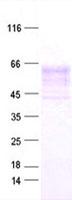 SERPINB4 / SCCA1+2 Protein