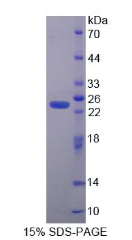 SERPINB4 / SCCA1+2 Protein - Recombinant Squamous Cell Carcinoma Antigen 1/2 By SDS-PAGE